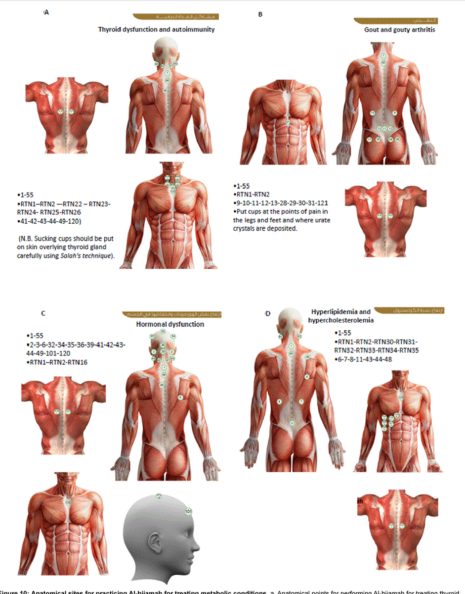 Figure 10 From Anatomical Sites For Practicing Wet Cupping Therapy Al Hijamah In Light Of Modern Medicine And Prophetic Medicine Semantic Scholar Figure 2 From Anatomical Sites For Practicing Wet Cupping Therapy Al Hijamah In Light Of Modern Medicine And Prophetic Medicine Semantic Scholar